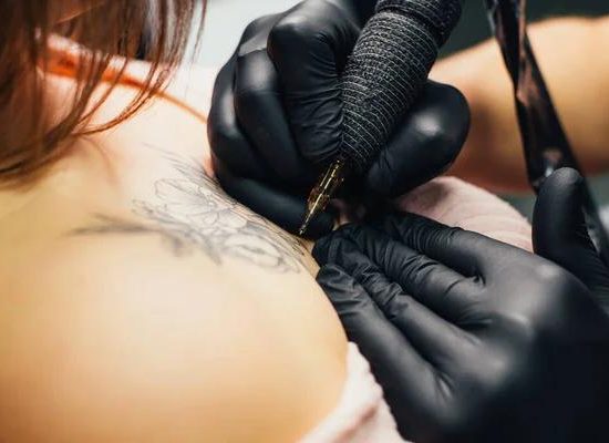 Mississauga Tattoo Removal: What You Need to Know