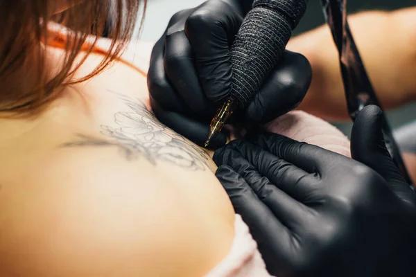 Mississauga Tattoo Removal: What You Need to Know